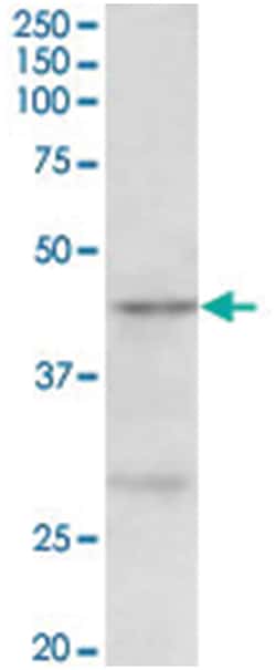PRMT6, Goat, Polyclonal Antibody, Abnova 100 &mu;g | Buy Online | Abnova Corporation | Fisher Scientific