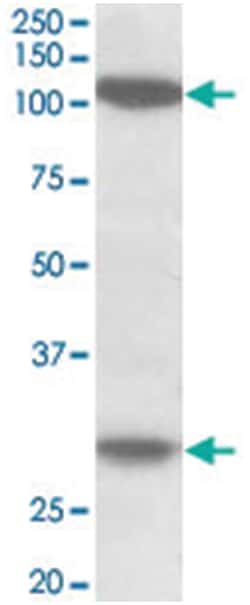 UBN1, Goat, Polyclonal Antibody, Abnova 100 &mu;g | Buy Online | Abnova | Fisher Scientific
