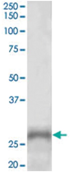 PHOX2A, Goat, Polyclonal Antibody, Abnova 100 &mu;g | Buy Online | Abnova Corporation | Fisher Scientific