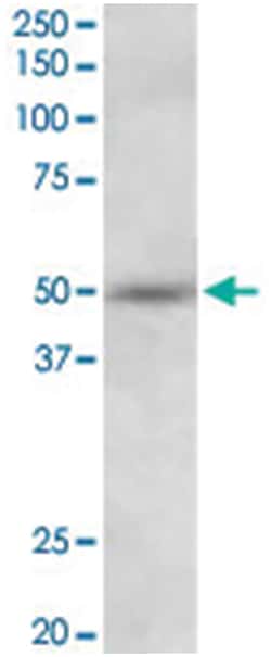 SYT9, Goat, Polyclonal Antibody, Abnova 100&mu;g; Unlabeled:Antibodies,