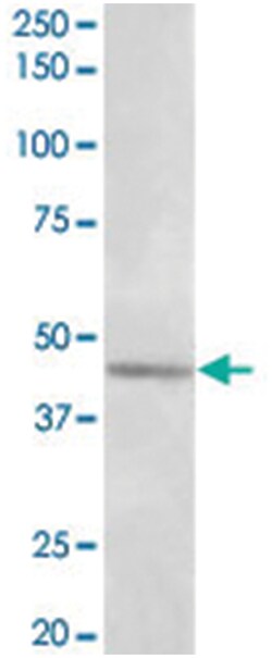Syt5, Goat, Polyclonal Antibody, Abnova 100 &mu;g | Buy Online | Abnova | Fisher Scientific