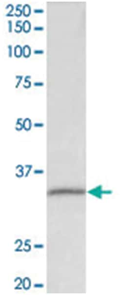 FBL Goat anti-Human, Polyclonal Antibody, Abnova 100 &mu;g | Buy Online | Abnova Corporation | Fisher Scientific