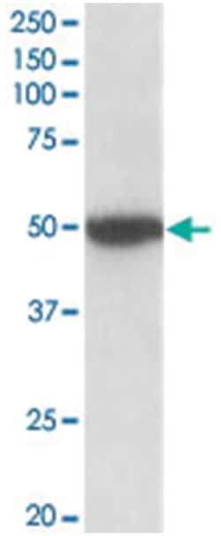 CHRM2, Goat, Polyclonal Antibody, Abnova 100 &mu;g | Buy Online | Abnova Corporation | Fisher Scientific