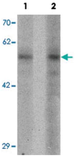 BMP15 Rabbit anti-Human, Mouse, Polyclonal Antibody, Abnova 100&mu;g; Unlabeled:Antibodies,