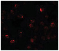 ZBTB40, Rabbit, Polyclonal Antibody, Abnova 100&mu;g; Unlabeled:Antibodies,
