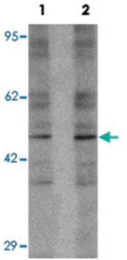 LEMD2 Rabbit anti-Human, Mouse, Polyclonal Antibody, Abnova 100&mu;g; Unlabeled:Antibodies,