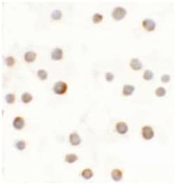 ABCA7, Rabbit, Polyclonal Antibody, Abnova 100 &mu;g | Buy Online | Abnova | Fisher Scientific