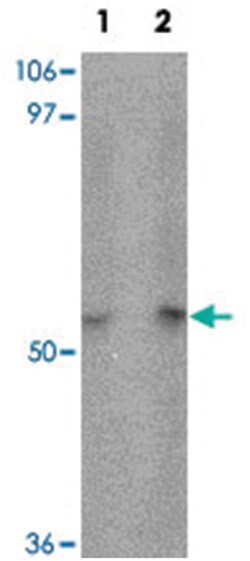 TTYH1, Rabbit, Polyclonal Antibody, Abnova 100 &mu;g | Buy Online | Abnova Corporation | Fisher Scientific