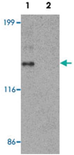 ZNF521 Rabbit anti-Human, Polyclonal Antibody, Abnova 100 &mu;g | Buy Online | Abnova Corporation | Fisher Scientific