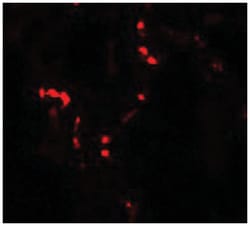 THBS4, Rabbit, Polyclonal Antibody, Abnova 100 &mu;g | Buy Online | Abnova Corporation | Fisher Scientific