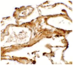 NBN Rabbit anti-Human, Mouse, Rat, Polyclonal Antibody, Abnova 100&mu;g;
