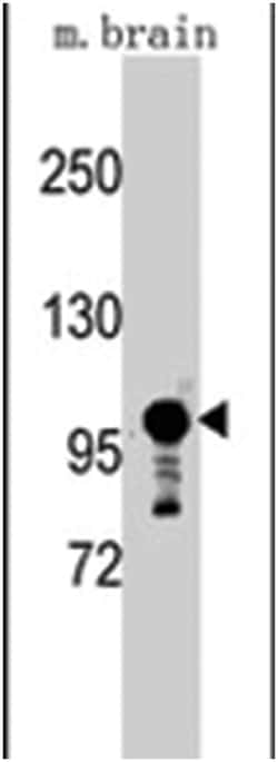 Sema5a, Rabbit, Polyclonal Antibody, Abnova 400&mu;L; Unlabeled:Antibodies,