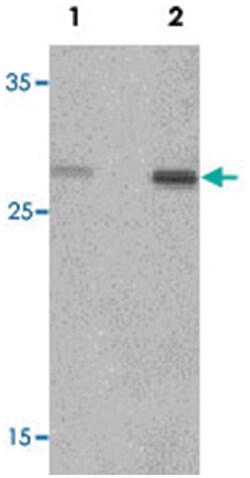 CLEC7A Rabbit anti-Human, Mouse, Rat, Polyclonal Antibody, Abnova 100&mu;g;