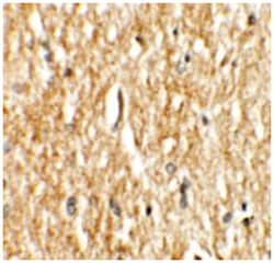 PHOX2A, Rabbit, Polyclonal Antibody, Abnova 100 &mu;g | Buy Online | Abnova Corporation | Fisher Scientific