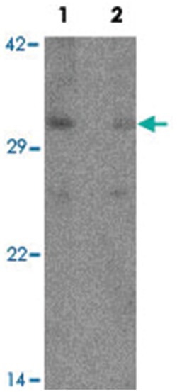 PHOX2A, Rabbit, Polyclonal Antibody, Abnova 100 &mu;g | Buy Online | Abnova Corporation | Fisher Scientific