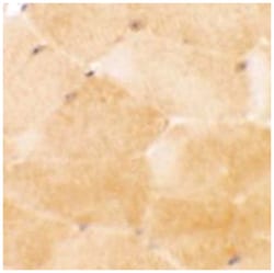 PRC1, Rabbit, Polyclonal Antibody, Abnova 100 &mu;g | Buy Online | Abnova Corporation | Fisher Scientific