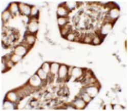 ZFX Rabbit anti-Human, Mouse, Rat, Polyclonal Antibody, Abnova 100 &mu;g | Buy Online | Abnova Corporation | Fisher Scientific