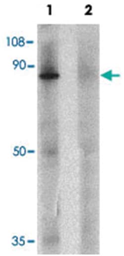 ZFX Rabbit anti-Human, Mouse, Rat, Polyclonal Antibody, Abnova 100 &mu;g | Buy Online | Abnova Corporation | Fisher Scientific
