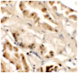 GZF1 Rabbit anti-Human, Polyclonal Antibody, Abnova 100 &mu;g | Buy Online | Abnova Corporation | Fisher Scientific