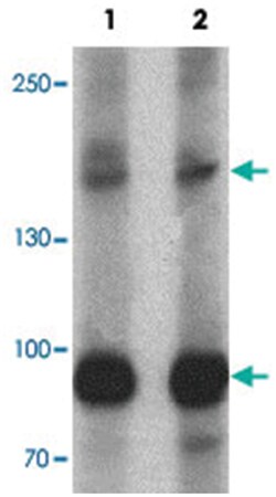 VPS13B, Rabbit, Polyclonal Antibody, Abnova 100μg; Unlabeled:Antibodies,