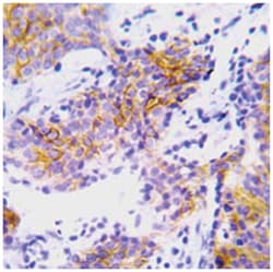 ALK Rabbit anti-Human, Polyclonal Antibody, Abnova 100 &mu;g | Buy Online | Abnova Corporation | Fisher Scientific