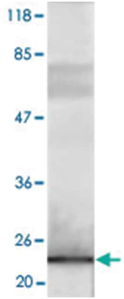 Flag tag, Rabbit, Polyclonal Antibody, Abnova 100 &mu;g | Buy Online | Abnova Corporation | Fisher Scientific