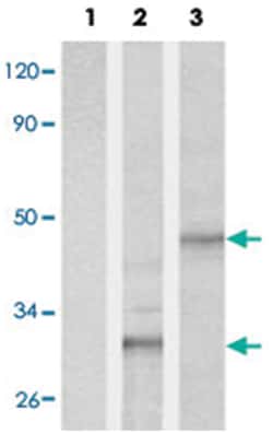 His tag Rabbit, Polyclonal Antibody, Abnova 100 &mu;g | Buy Online | Abnova Corporation | Fisher Scientific
