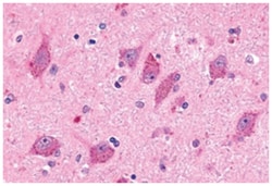 BAI2 Rabbit anti-Human, Polyclonal Antibody, Abnova 50&mu;g; Unlabeled:Antibodies,
