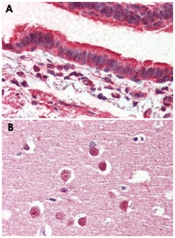 GPR98 Rabbit anti-Human, Polyclonal Antibody, Abnova 50 &mu;g | Buy Online | Abnova Corporation | Fisher Scientific