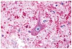 HTR4 Rabbit anti-Bovine, Dog, Horse, Human, Monkey, Pig, Rabbit, Polyclonal