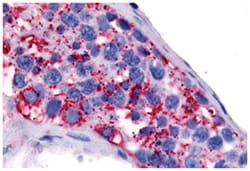 HTR1E Rabbit anti-Bovine, Guinea pig, Horse, Human, Monkey, Polyclonal Antibody, Abnova 50 &mu;g | Buy Online | Abnova Corporation | Fisher Scientific