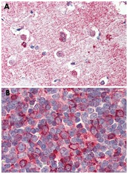 GPR26 Rabbit anti-Bovine, Dog, Horse, Human, Monkey, Polyclonal Antibody, Abnova 50 &mu;g | Buy Online | Abnova | Fisher Scientific