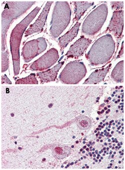 NEK7 Rabbit anti-Bovine, Chicken, Dog, Hamster, Horse, Human, Monkey, Mouse, Pig, Rabbit, Rat, Polyclonal Antibody, Abnova 50 &mu;g | Buy Online | Abnova | Fisher Scientific
