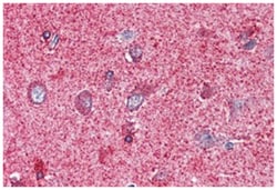 PAK7 Rabbit anti-Human, Polyclonal Antibody, Abnova 50&mu;g; Unlabeled:Antibodies,