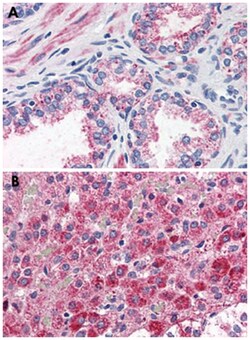 CCKAR Rabbit anti-Dog, Human, Monkey, Polyclonal Antibody, Abnova 50&mu;g;