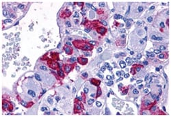 ADCYAP1R1 Rabbit anti-Human, Monkey, Polyclonal Antibody, Abnova 50&mu;g;