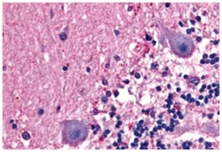 BAI1 Rabbit anti-Bovine, Chicken, Hamster, Human, Monkey, Mouse, Rat, Polyclonal Antibody, Abnova 50 &mu;g | Buy Online | Abnova Corporation | Fisher Scientific