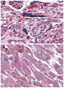 ADCYAP1R1 Rabbit anti-Bovine, Human, Monkey, Polyclonal Antibody, Abnova