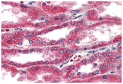 ERAP1 Rabbit anti-Human, Polyclonal Antibody, Abnova 50&mu;g; Unlabeled:Antibodies,