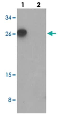 BATF, Rabbit, Polyclonal Antibody, Abnova 100 &mu;g | Buy Online | Abnova Corporation | Fisher Scientific