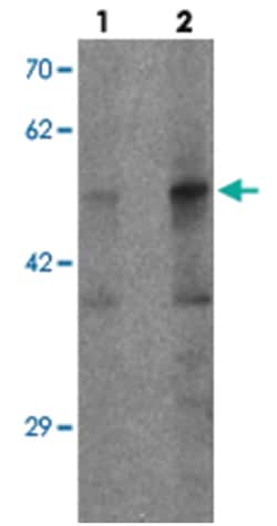 PLA1A, Rabbit, Polyclonal Antibody, Abnova 100&mu;g; Unlabeled:Antibodies,