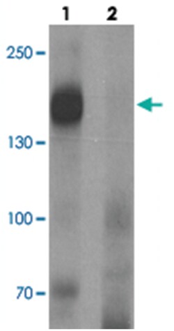 LNPEP, Rabbit, Polyclonal Antibody, Abnova 100 &mu;g | Buy Online | Abnova Corporation | Fisher Scientific