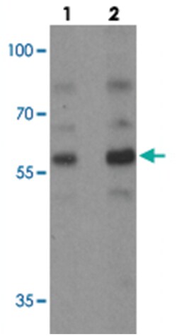 PLAGL2, Rabbit, Polyclonal Antibody, Abnova 100 &mu;g | Buy Online | Abnova | Fisher Scientific