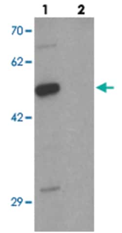 DCP2, Rabbit, Polyclonal Antibody, Abnova 100&mu;g; Unlabeled:Antibodies,