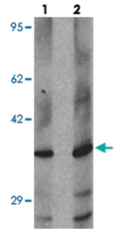 DLK1, Rabbit, Polyclonal Antibody, Abnova 100&mu;g; Unlabeled:Antibodies,