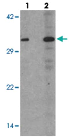 CDKN1C Rabbit anti-Human, Polyclonal Antibody, Abnova 100 &mu;g | Buy Online | Abnova Corporation | Fisher Scientific