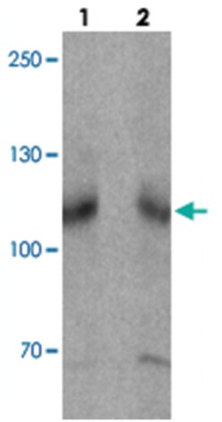 SCUBE3, Rabbit, Polyclonal Antibody, Abnova 100 &mu;g | Buy Online | Abnova | Fisher Scientific