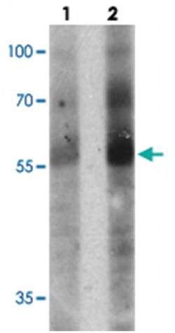 TOX Rabbit anti-Human, Polyclonal Antibody, Abnova 100 &mu;g | Buy Online | Abnova Corporation | Fisher Scientific