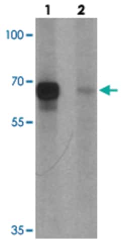 BCL6 Rabbit anti-Human, Mouse, Rat, Polyclonal Antibody, Abnova 100&mu;g;