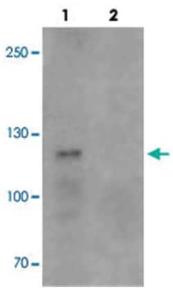 TCIRG1, Rabbit, Polyclonal Antibody, Abnova 100 &mu;g | Buy Online | Abnova Corporation | Fisher Scientific